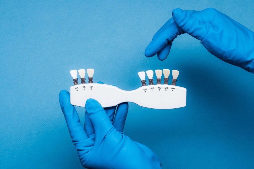 cost of full mouth dental implants